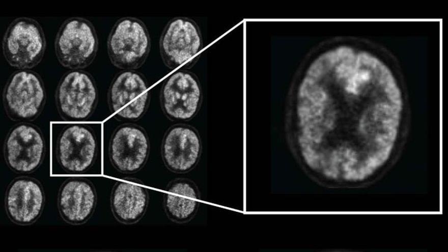 Científicos de Taiwán descubren un nuevo método para tratamiento del cáncer cerebral