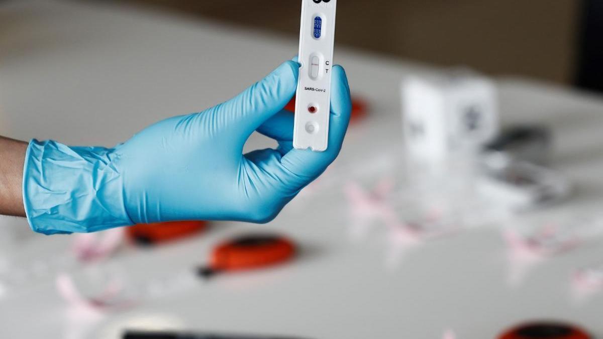 Las farmacias extremeñas venderán test para detectar anticuerpos covid