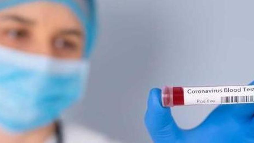 19 muertos y 562 afectados por coronavirus en Baleares