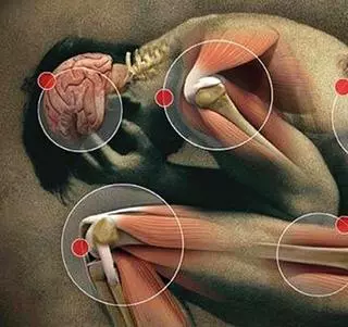 Lo que hay que saber de los medicamentos más recetados del mundo: los antiinflamatorios no esteroideos (Aine)