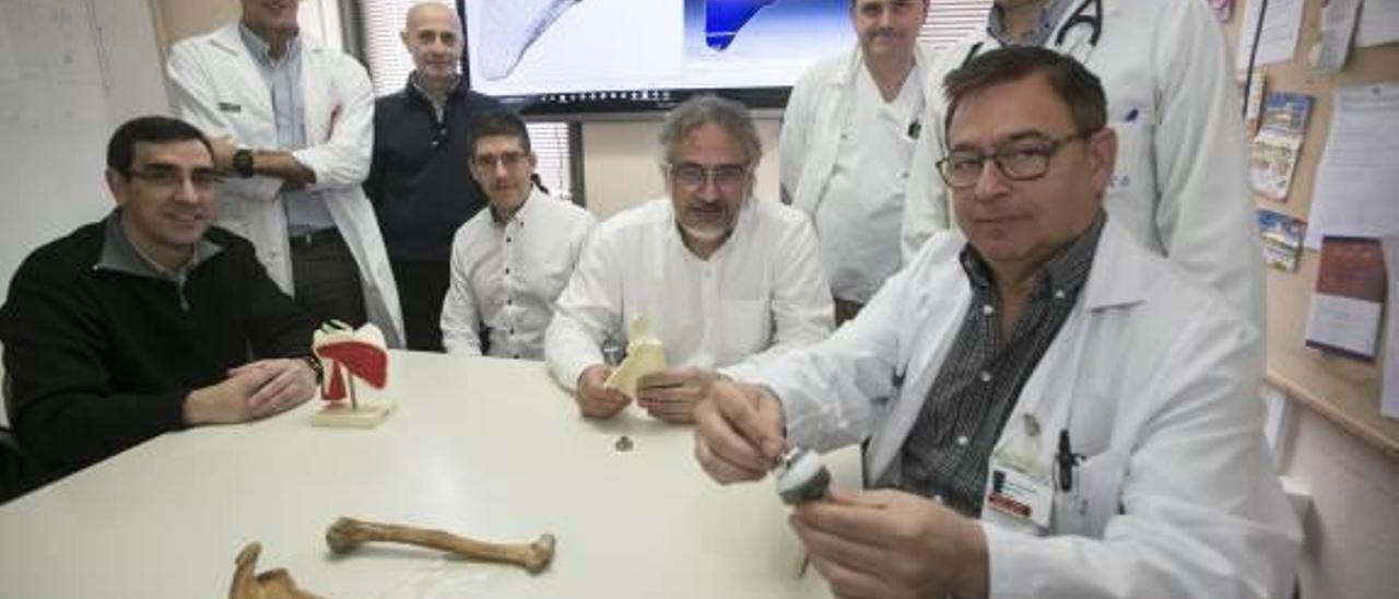 El Hospital de Sant Joan y la UPV de Alcoy crean prótesis a medida con impresoras 3D