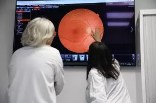 Ictus de retina: la enfermedad indolora que puede preceder a un infarto o derrame cerebral