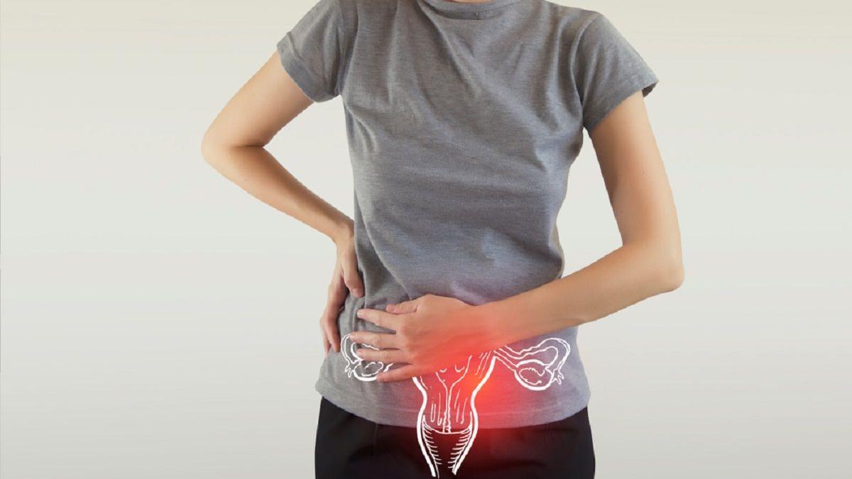 Cáncer de útero: el cáncer que se puede prevenir