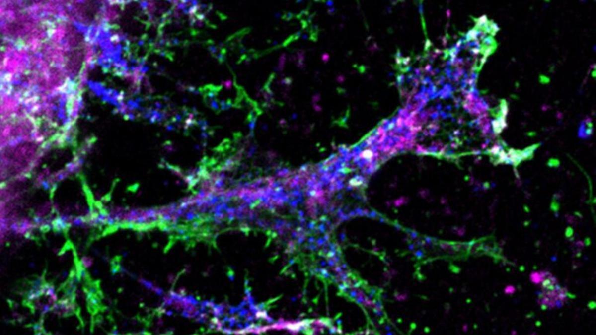 Descubren cómo conseguir que el cerebro se recupere después de una lesión