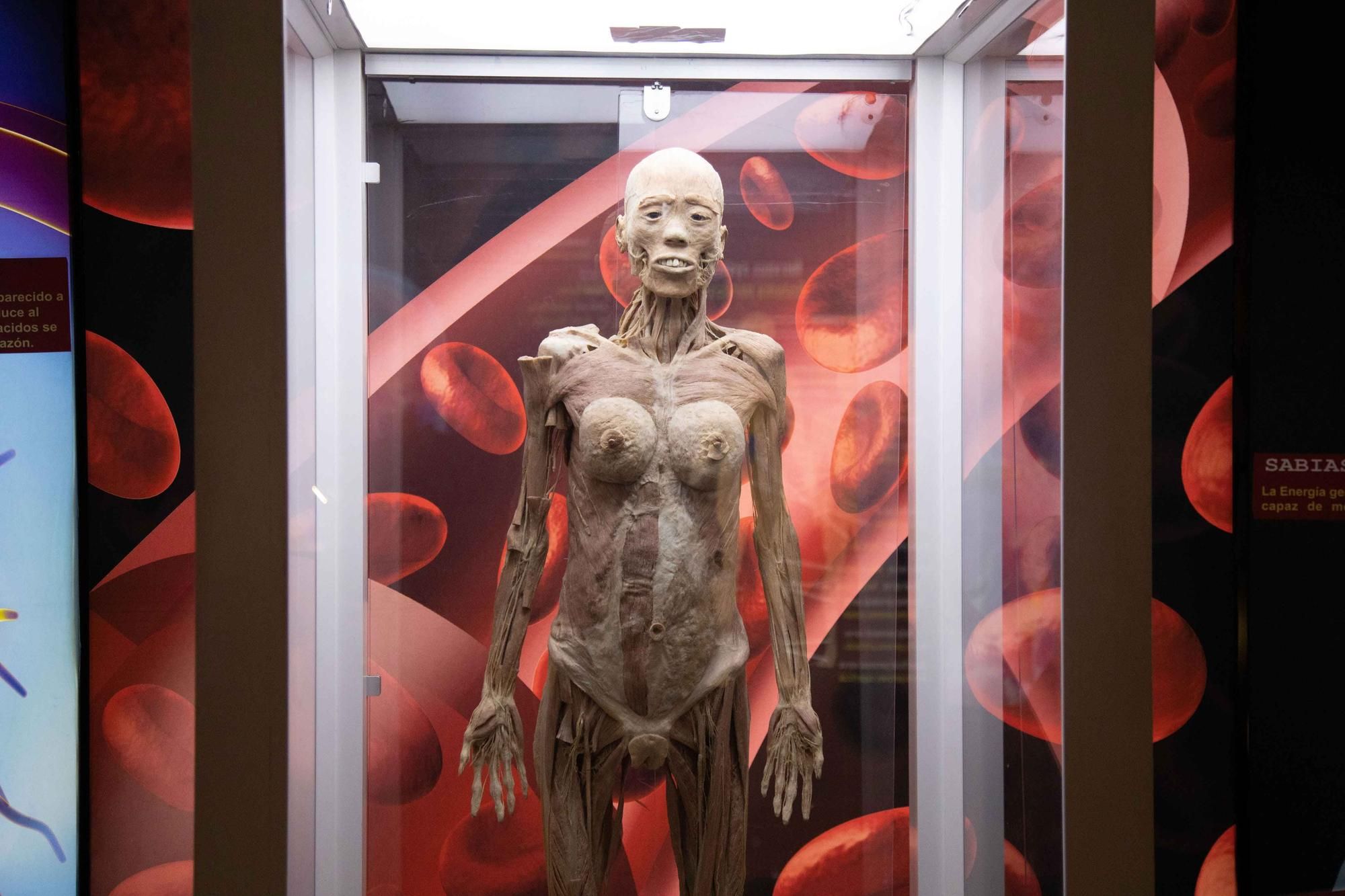 Präparierte menschliche Körper und Organe in der Ausstellung "Bodies" bewundern