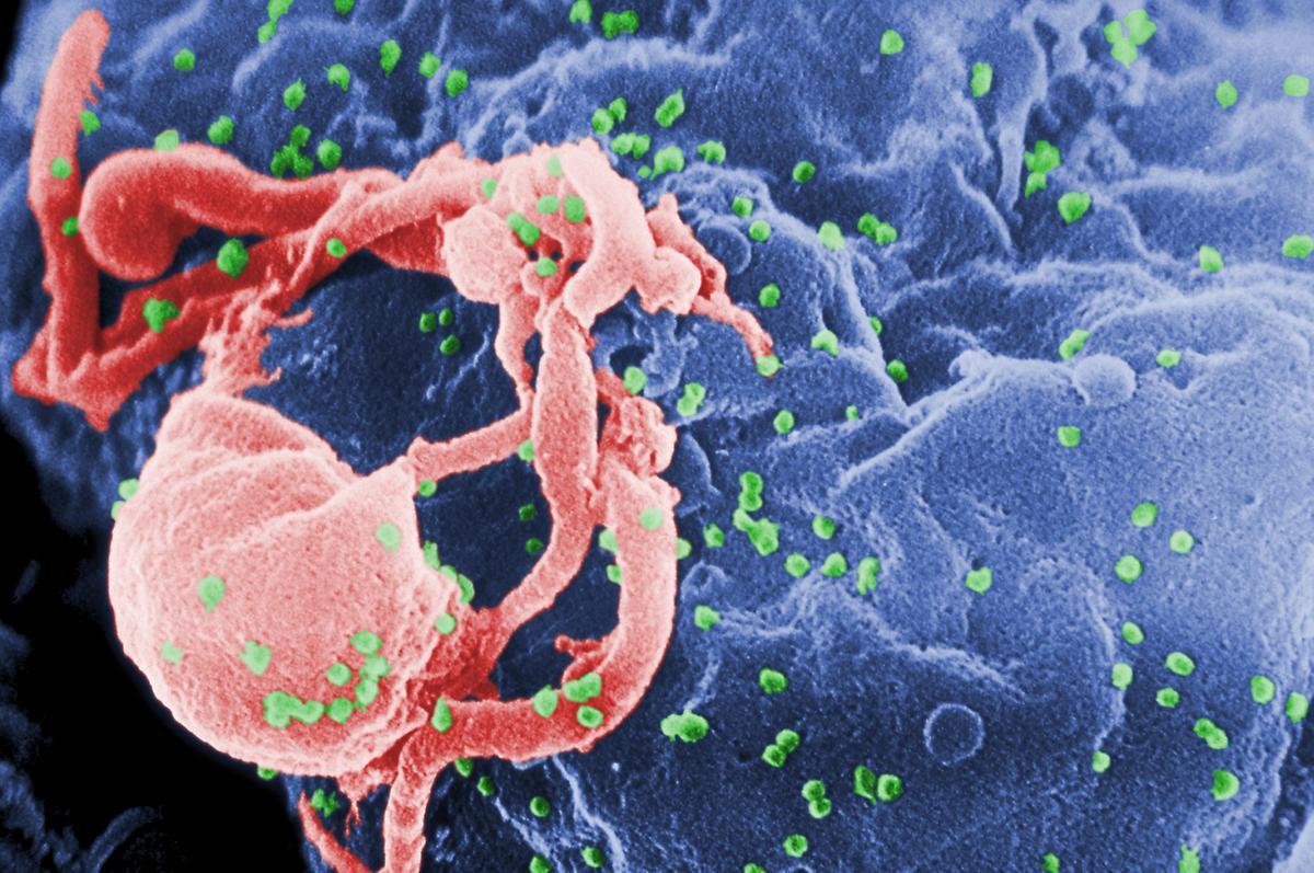 Microfotografía con MEB de VIH-1 en liberación (en verde) en un cultivo de linfocitos