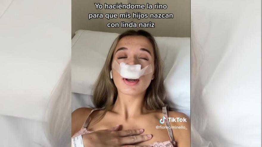 Burlas a una tiktoker que se hizo una rinoplastia: &quot;Mis hijos nacerán con una linda nariz&quot;