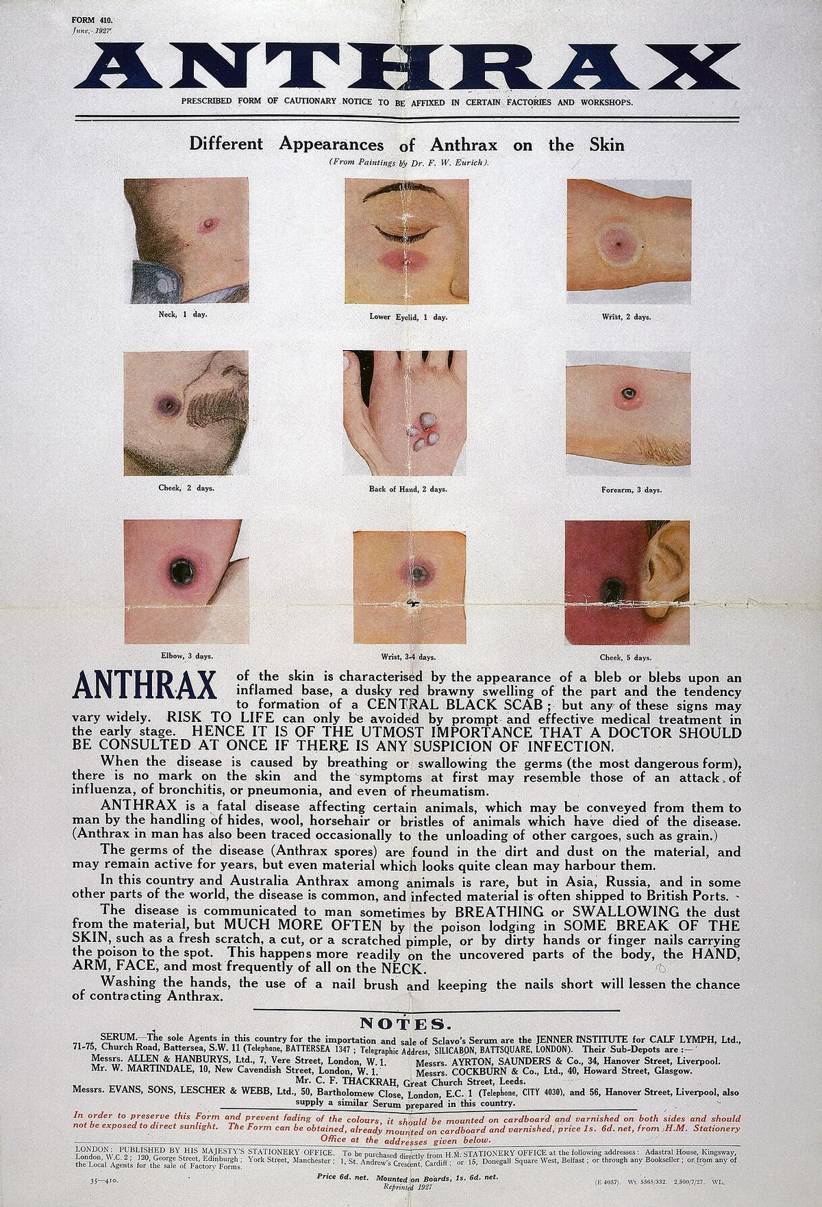 Poster presentando las diferentes apariencias de las heridas de ántrax