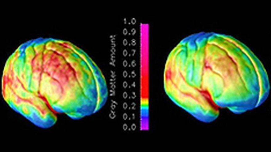 Obama apoya un mapa de la actividad del cerebro