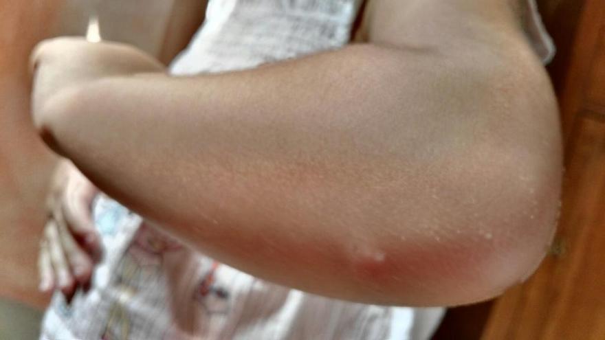 Invasión de mosquitos en Torrevieja: el Ayuntamiento toma medidas urgentes