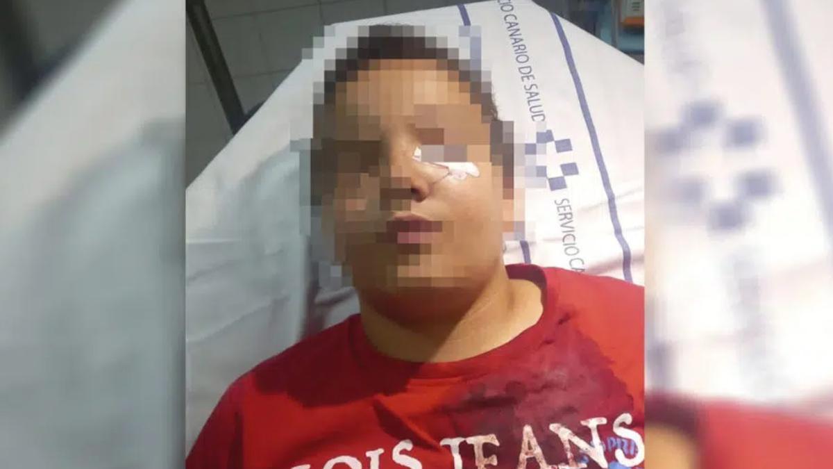 Un niño de 11 años de Canarias acaba hospitalizado tras defender a su abuelo