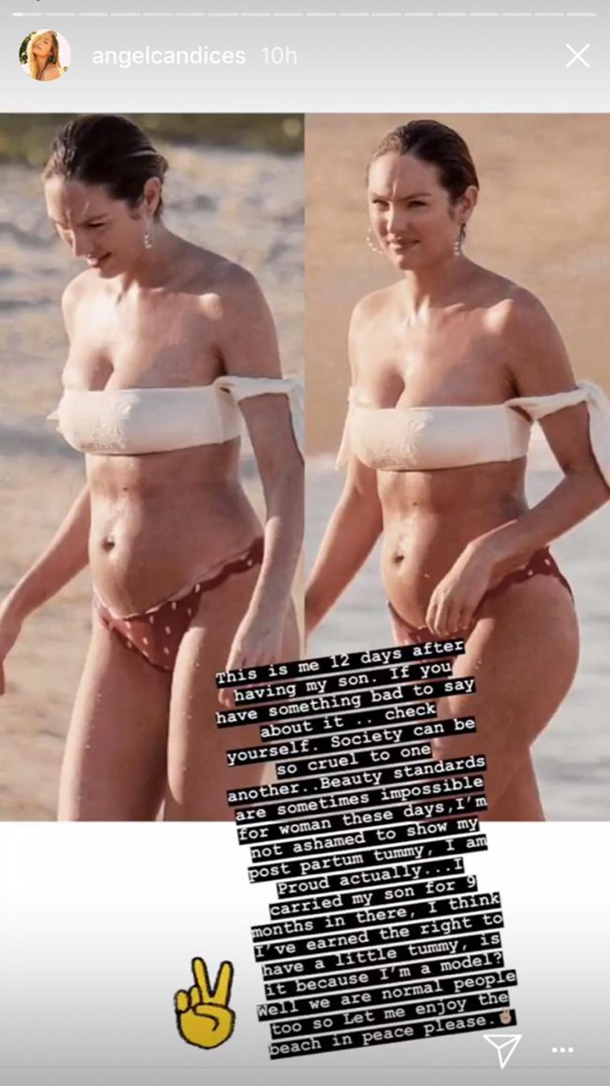 El 'stories' body positive de Candice Swanepoel