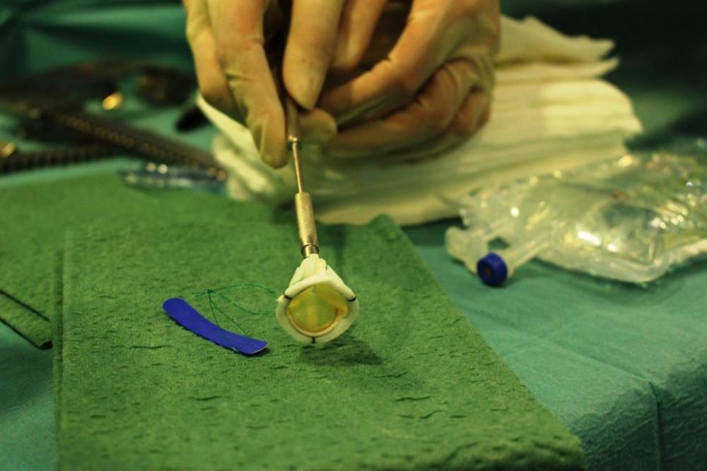 Operació pionera al Trueta per implantar una vàlvula cardíaca biològica