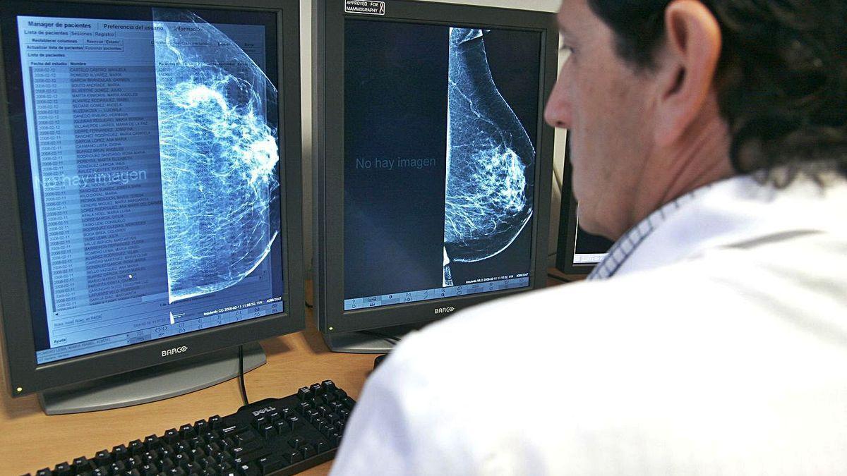 Un médico consulta una mamografía en una pantalla.