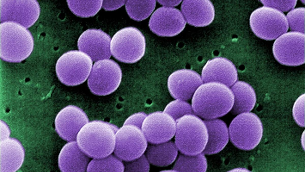 Cepa de la bacteria Staphylococcus aureus extraída de un cultivo