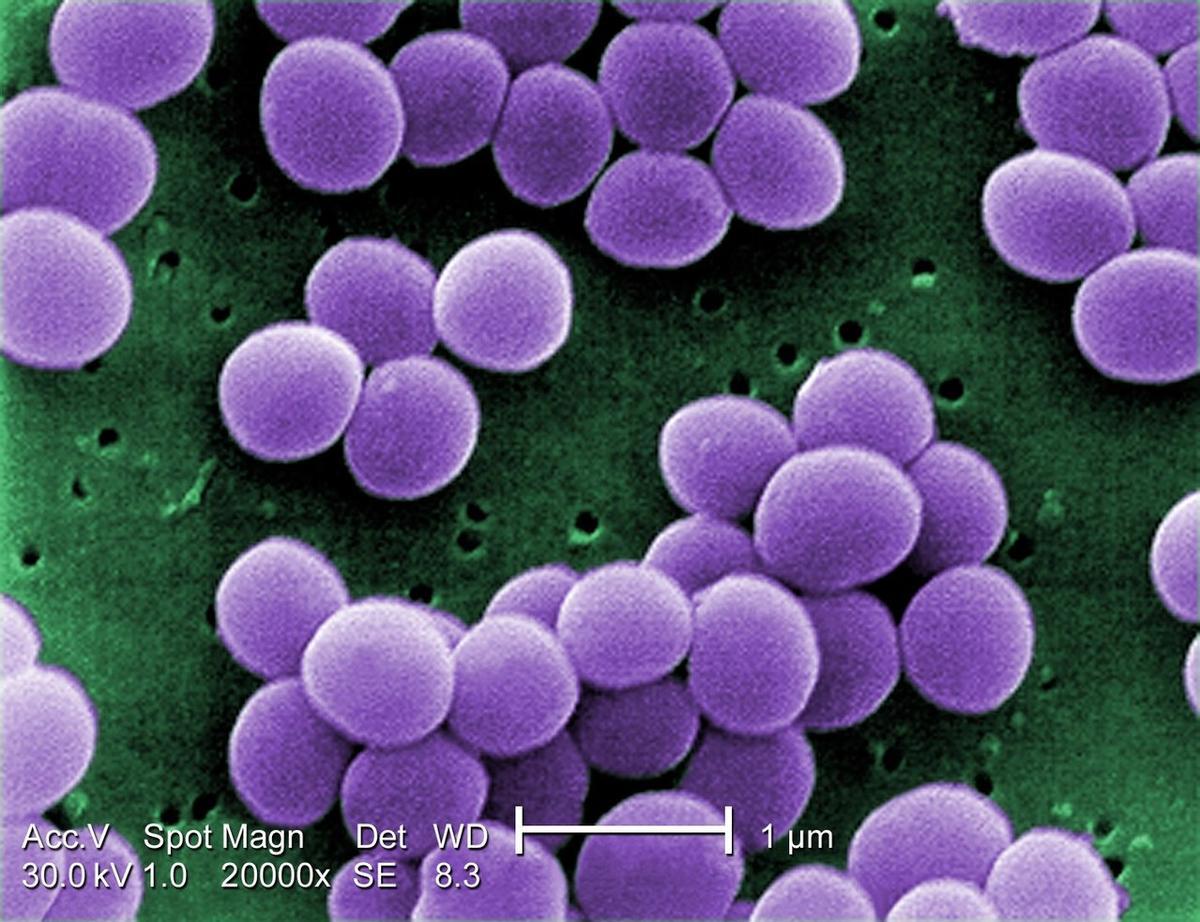 Cepa de la bacteria Staphylococcus aureus extraída de un cultivo