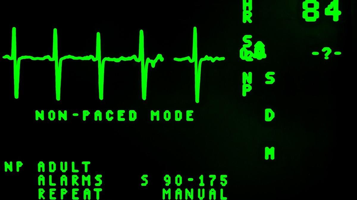 el El electrocardiograma proporciona mucha información a los especialistas en cardiología.