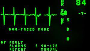 el El electrocardiograma proporciona mucha información a los especialistas en cardiología.