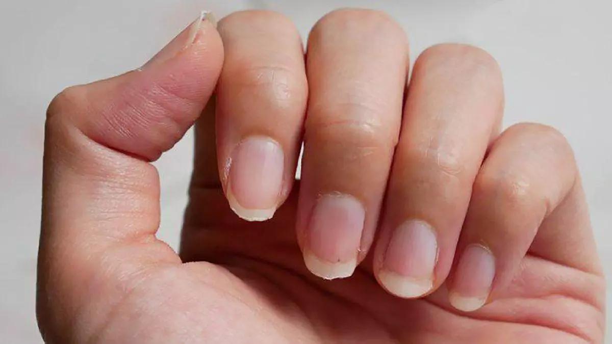 Imagen de archivo de unas uñas