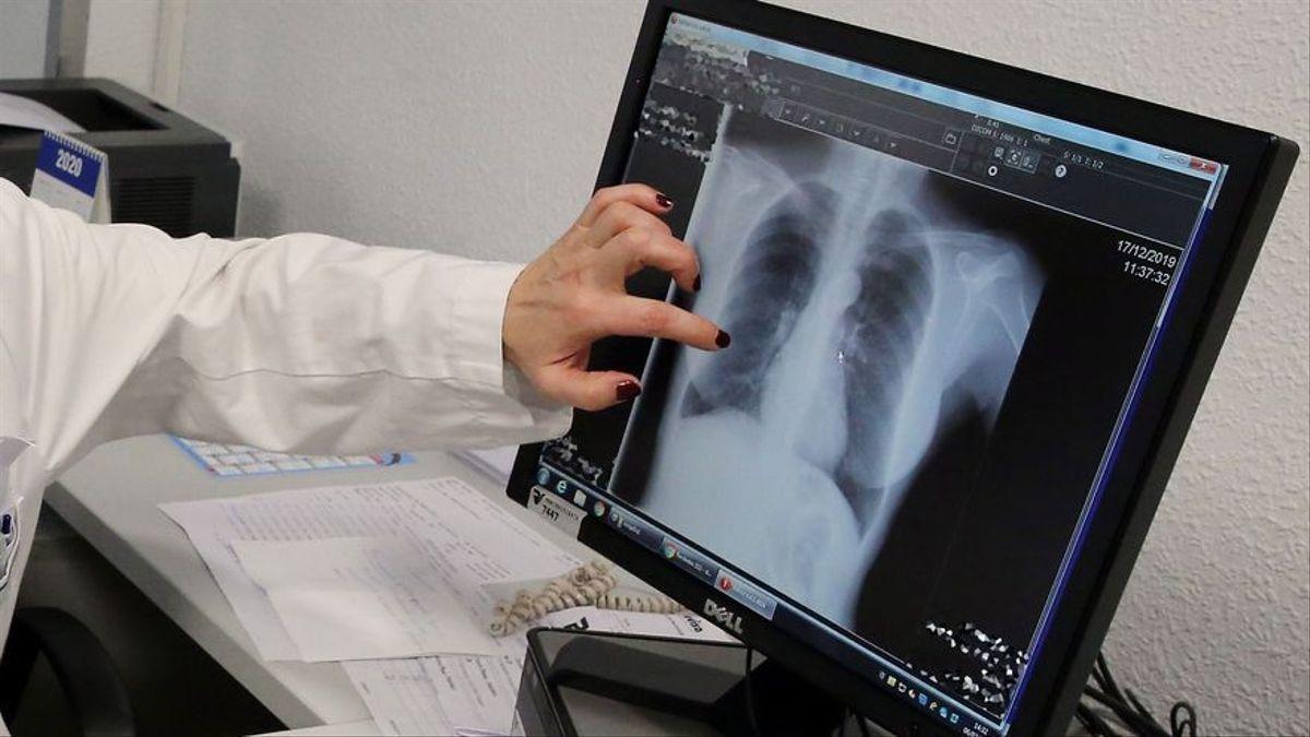 Uno de cada 10 trabajadores tiene que cambiar de empleo tras contraer cáncer.