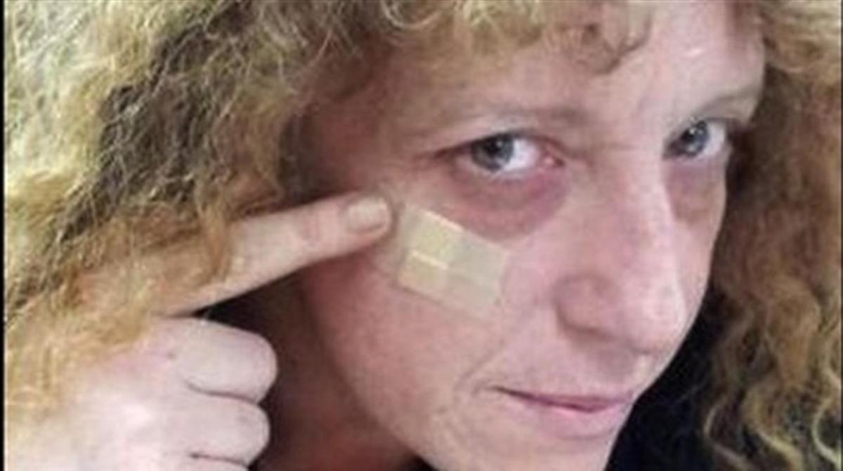Agredida María Díaz, actriu d’’Aída’. Agredida María Díaz, actriu d’’Aída’.