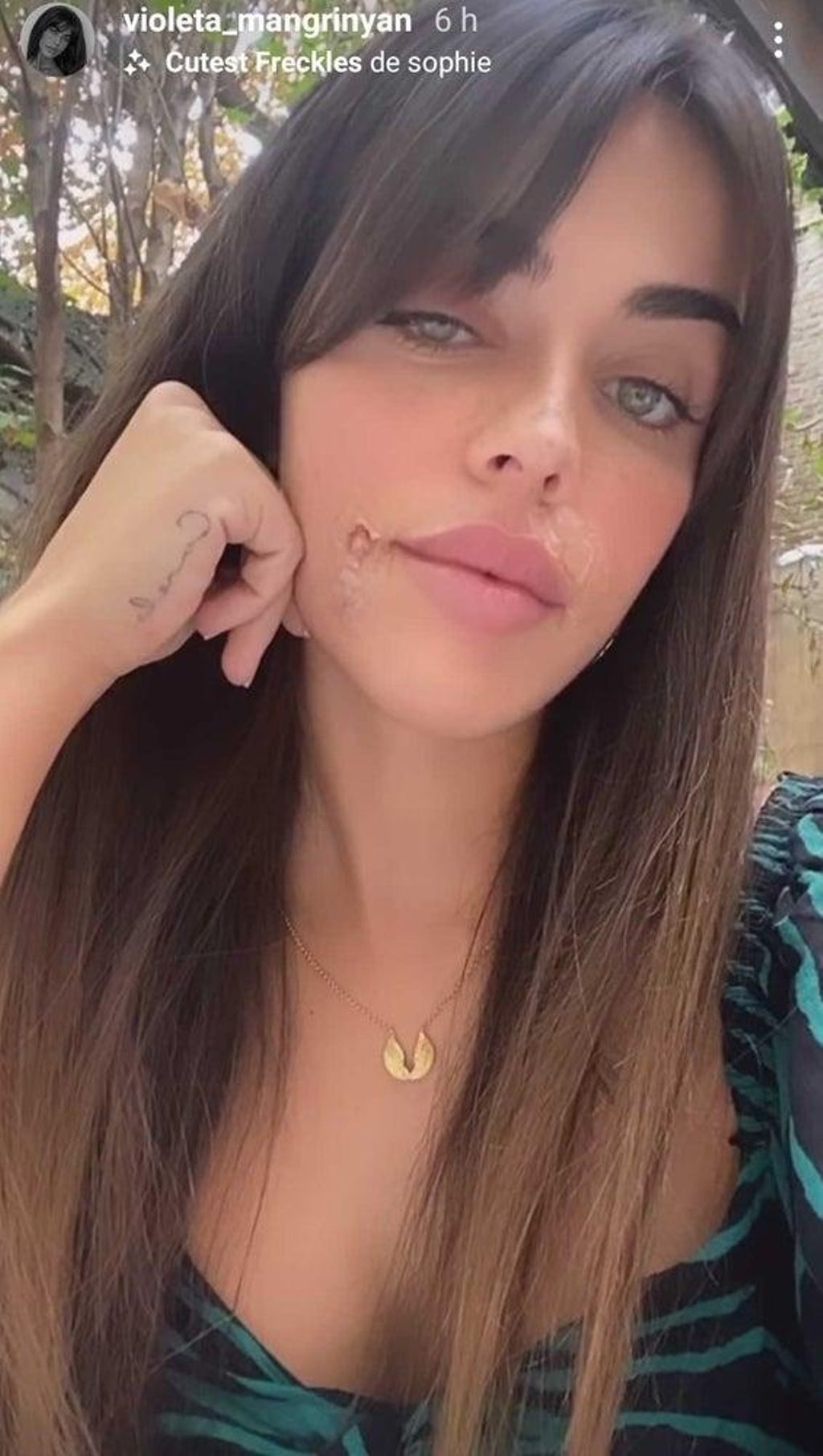 Violeta Mangriñán con marcas de sus retoques
