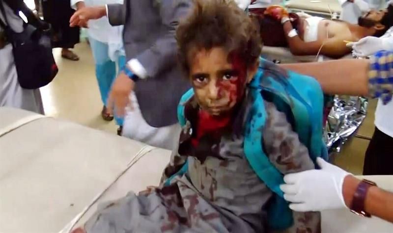 29 niños muertos en un bombardeo en Yemen
