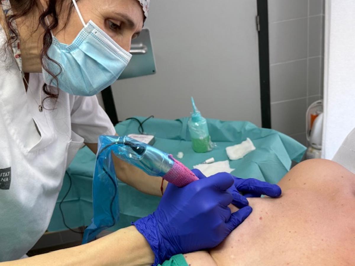 Image de una sesión de micropigmentación mamaria en el Hospital de la Ribera.