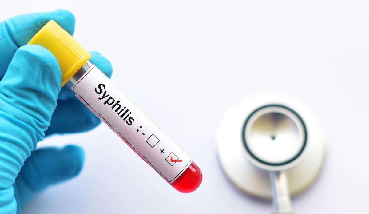 La sífilis, una enfermedad de transmisión sexual.