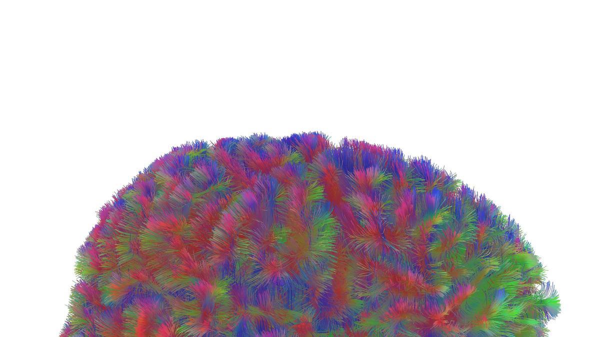 El cerebro pasa por 5 fases en la vida, que cambian a los 9, 32, 66 y 83 años