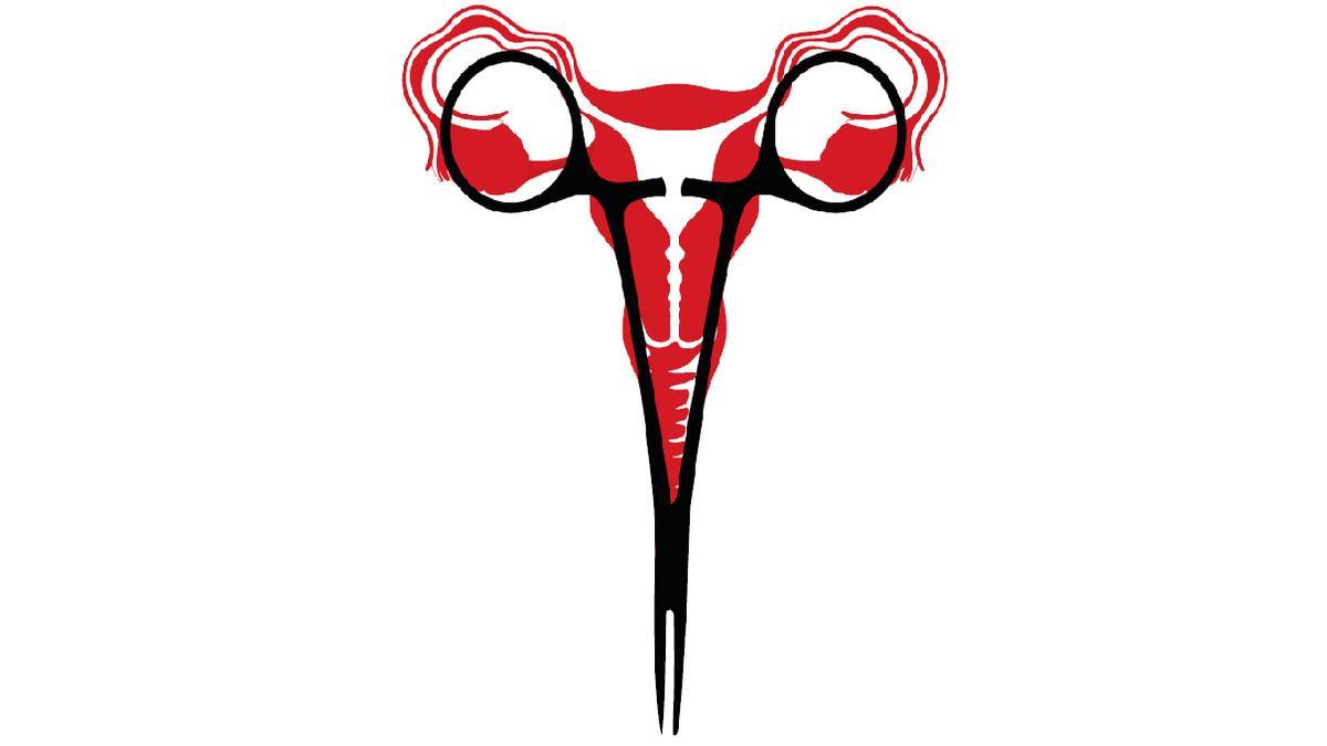 Ilustración sobre el aborto