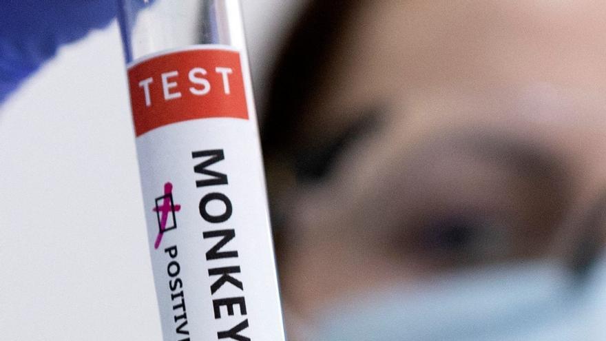 Confirman otros cinco casos de viruela del mono