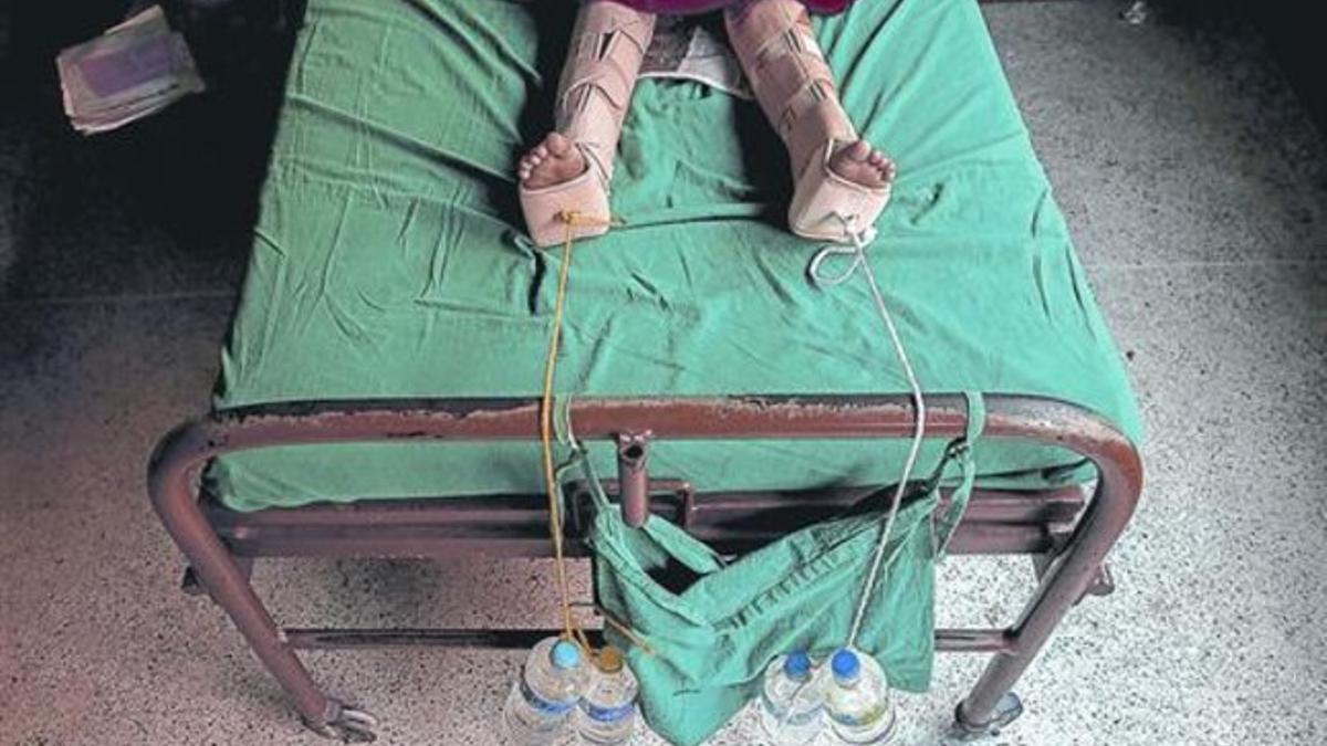Botellas de agua sujetan las piernas de un herido en un hospital de Katmandú, este miércoles.