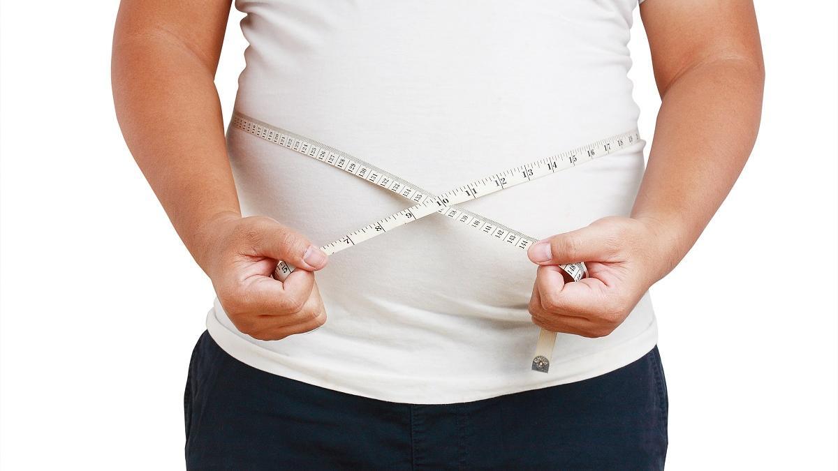 La obesidad es uno de los factores desencadenantes de la hidradenitis supurativa.