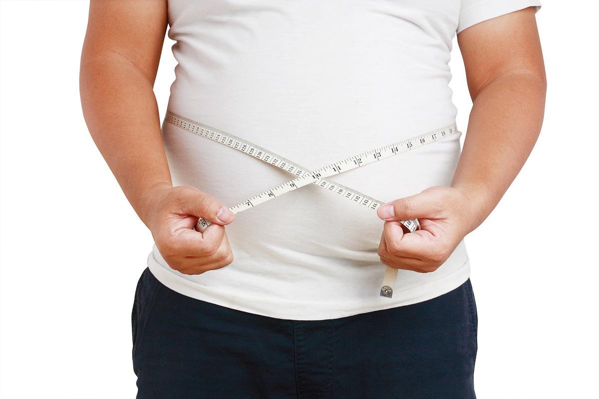 La obesidad es uno de los factores desencadenantes de la hidradenitis supurativa.