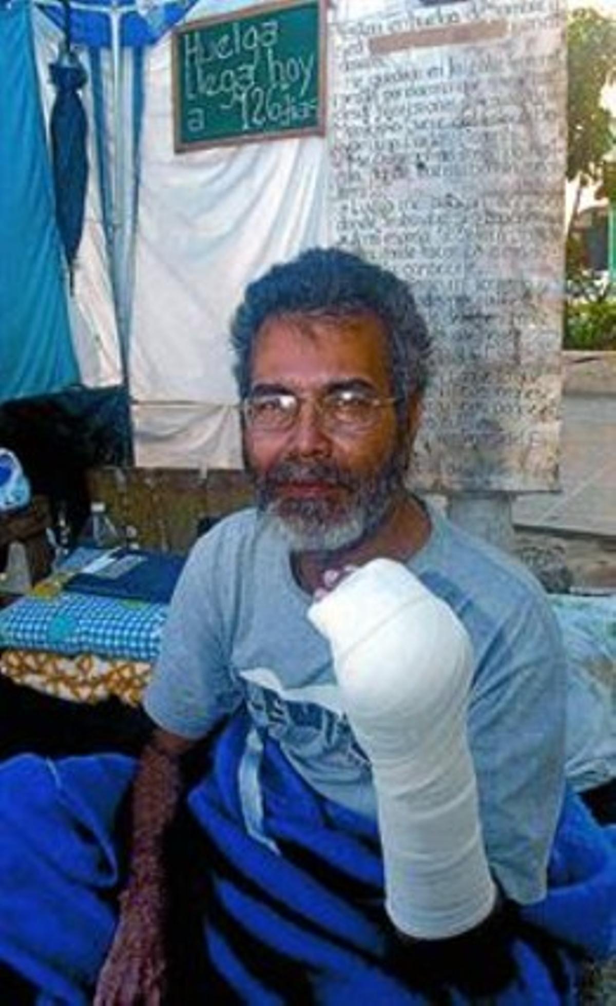 Brito, el 2005, després de tallar-se el dit petit. Brito, el 2005, després de tallar-se el dit petit.