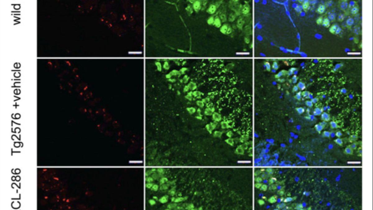 BRCA1 en las neuronas de los ratones tratados con KCL-286, como se puede ver en estos cortes teñidos de tejido del hipocampo.