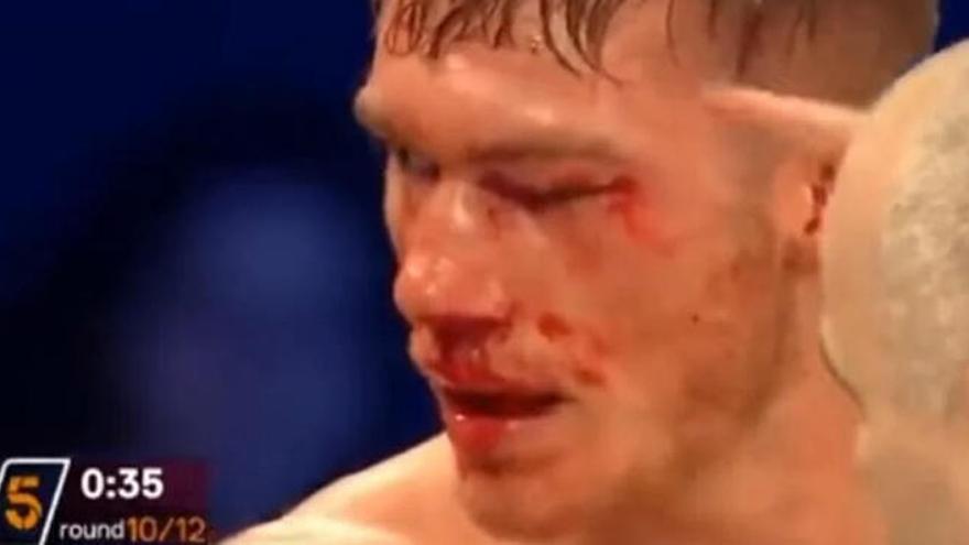 Un boxeador, en coma inducido tras un combate en Londres