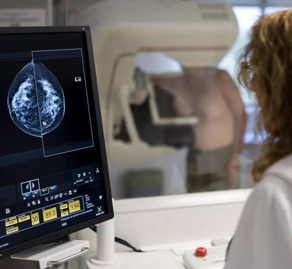 El 20% del càncer de mama es detecta en fase precancerosa