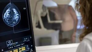 El 20% del càncer de mama es detecta en fase precancerosa