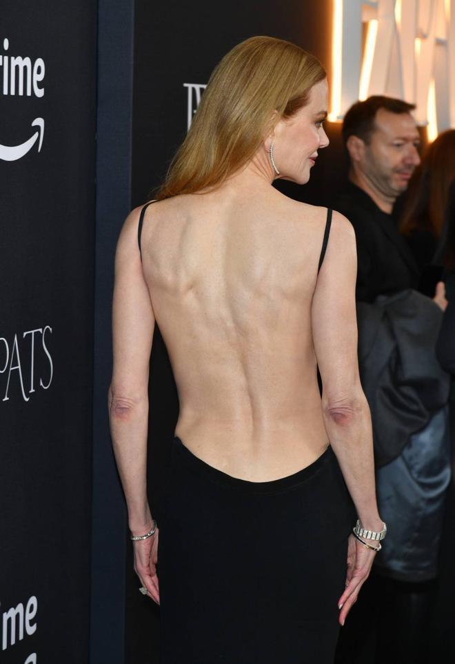 Detalle del escote en la espalda de Nicole Kidman