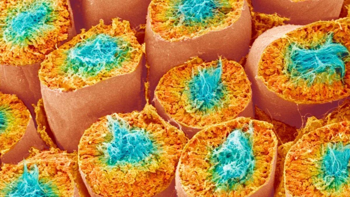 Los espermatozoides en desarrollo (azul) llenan el centro de los túbulos seminíferos (naranja), que forman el testículo humano.