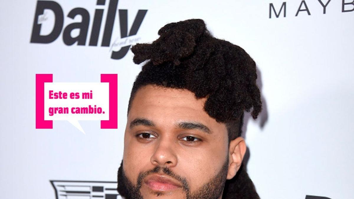 Irreconocible: The Weeknd se parte la cara por los MTV VMAs