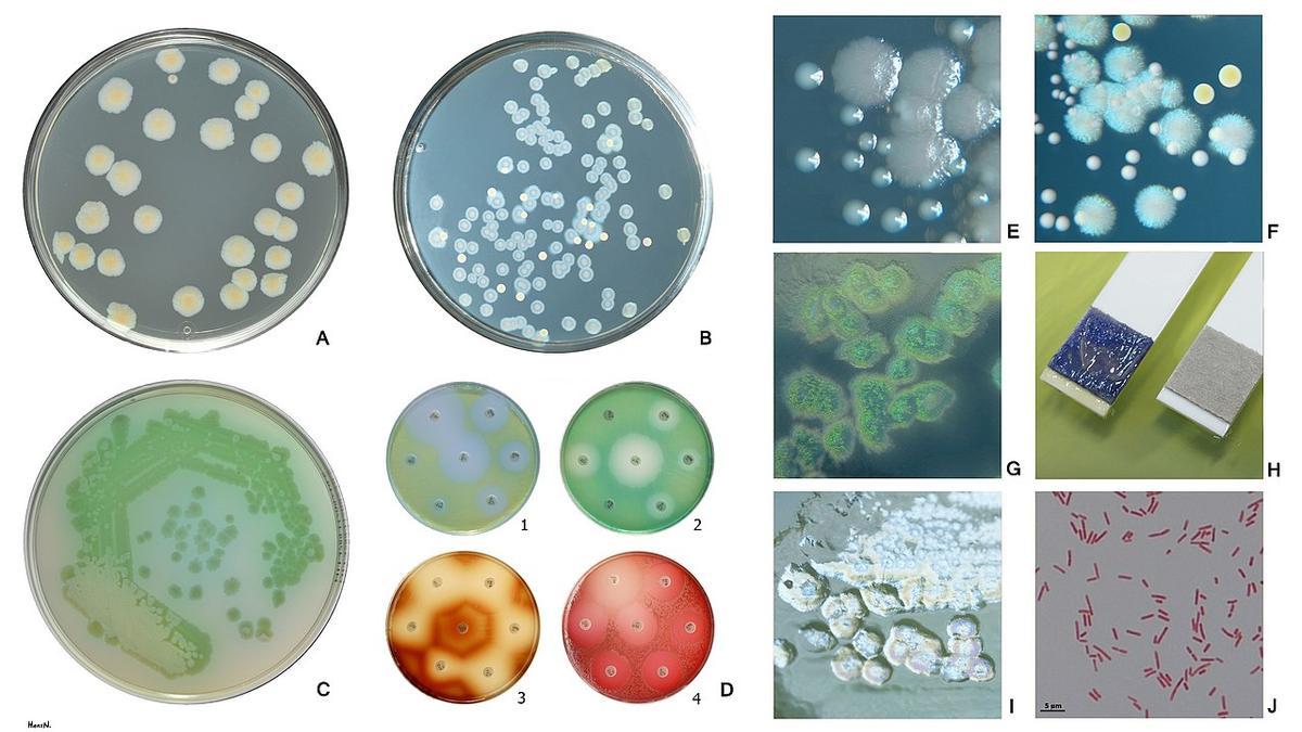 Cepas de  Pseudomonas aeruginosa con diferentes medios