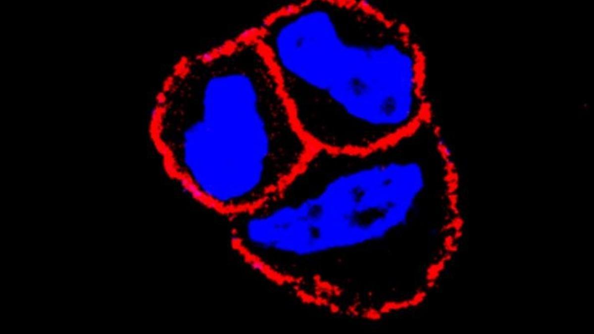 El CSIC evidencia que el uso combinado de un nuevo fármaco mejora la eficiencia de algunas terapias de cáncer de mama.