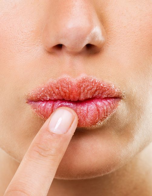Evita que tus labios se agrieten