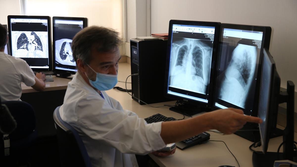 El Hospital Vall d’Hebron prueba diagnosticar el coronavirus con inteligencia artificial. Lo explica el doctor Manuel Escobar, director de la Clínica de diagnóstico por la imagen y medicina nuclear de Vall d’Hebron.