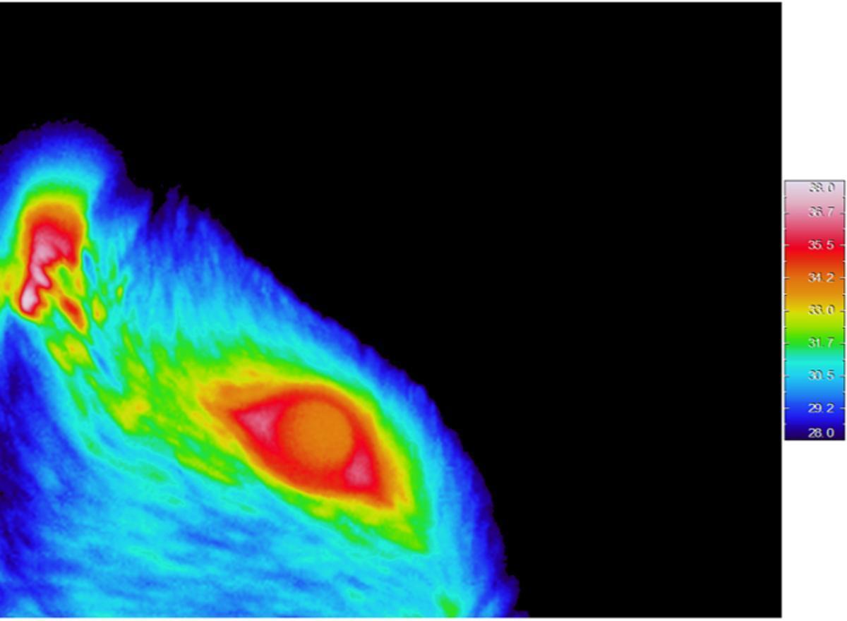 Imagen de la superficie ocular