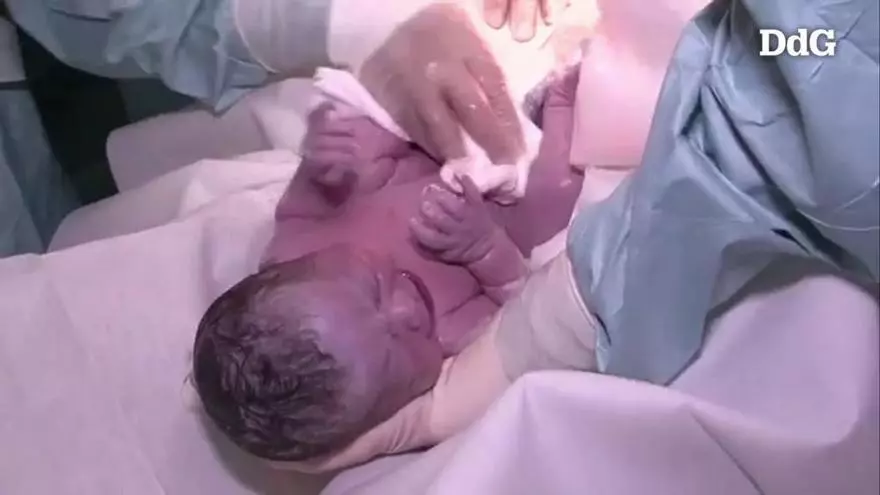 Un estudi demostra que les cesàries augmenten el risc dels infants de tenir asma