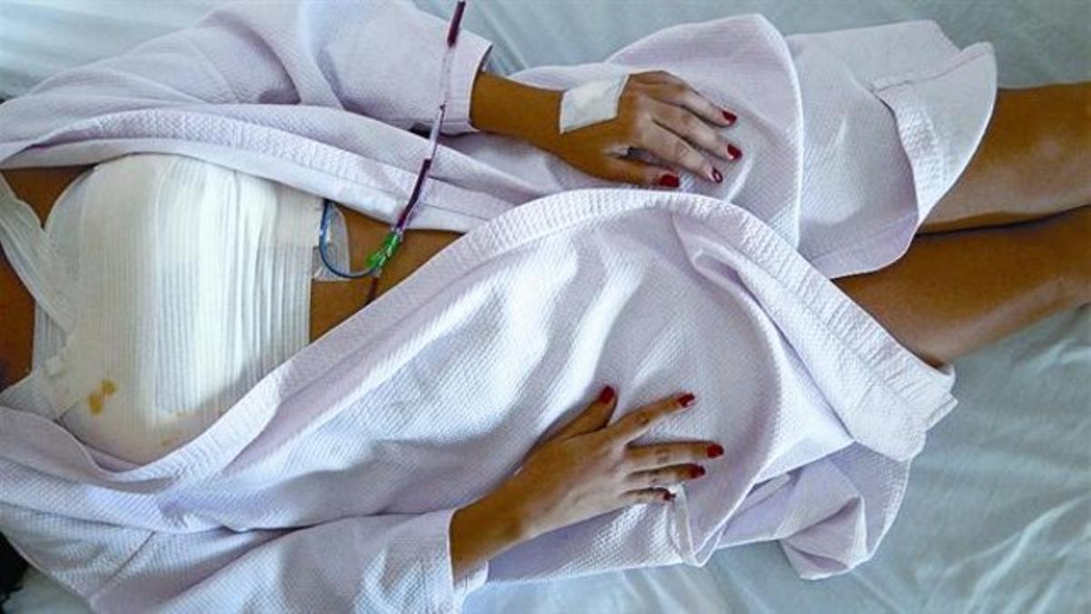 Una turista espanyola, després d’una operació de pròtesis mamàries, en una clínica de Rabat. Una turista espanyola, després d’una operació de pròtesis mamàries, en una clínica de Rabat.